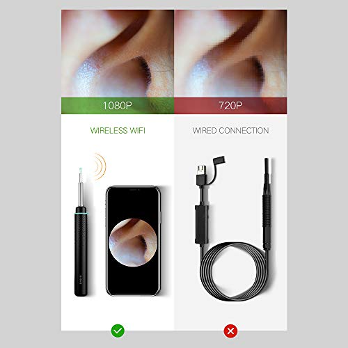 BEBIRD M9 Pro Metal Design Smart Visual Ear Otoscope, 1080P Wireless Ear Camera, Reusable Ear Wax Removal Tools, Professional Home Ear Inspection for Kids and Adults, Works with iPhone, iPad, Android