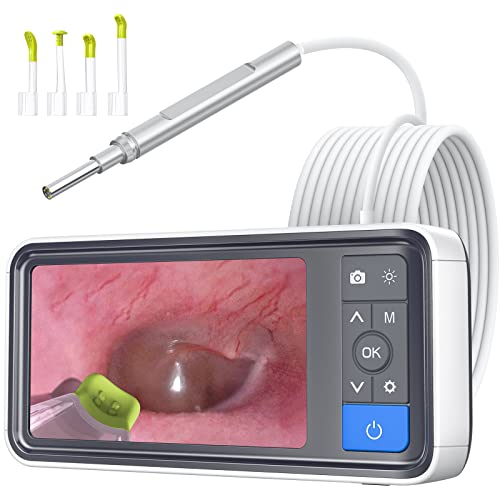 ScopeAround Ear Wax Removal Camera with 4.5" IPS Screen, 1920x1080 FHD Smart Visual Ear Cleaner with Camera Tool Kit, Plug & Play at Home Ear Infection Detector Ear Wax Remover Otoscope with Light