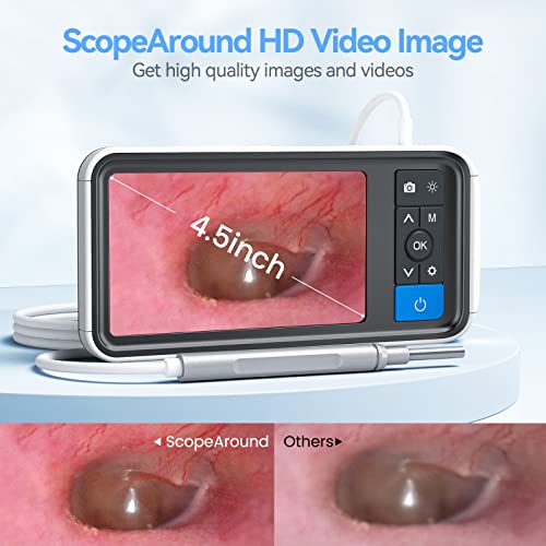 ScopeAround Ear Wax Removal Camera with 4.5" IPS Screen, 1920x1080 FHD Smart Visual Ear Cleaner with Camera Tool Kit, Plug & Play at Home Ear Infection Detector Ear Wax Remover Otoscope with Light