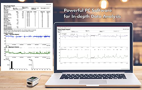 EMAY Sleep Oxygen Monitor with PC Software & App | Bluetooth Pulse Oximeter Rechargeable for Overnight & Continuous SpO2 Tracking with 72 Hours Built-in Memory | Gives Informative Report & Analysis
