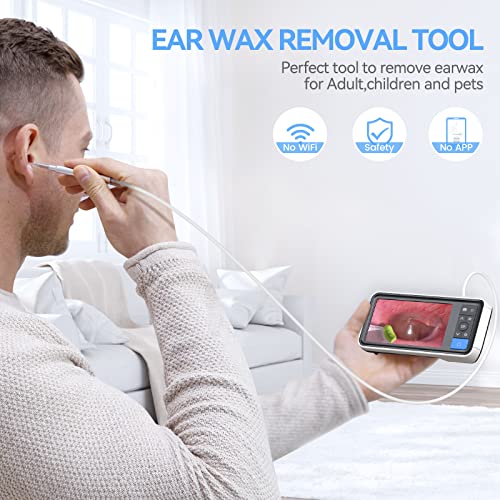 ScopeAround Ear Wax Removal Camera with 4.5" IPS Screen, 1920x1080 FHD Smart Visual Ear Cleaner with Camera Tool Kit, Plug & Play at Home Ear Infection Detector Ear Wax Remover Otoscope with Light